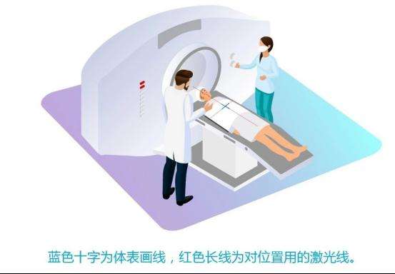 放疗定位多少钱(放疗定位复位一次各要多少钱)